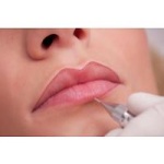 Dermopigmentación de labios también conocida como maquillaje permanente